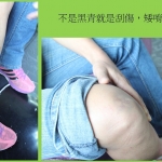 好痛