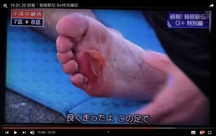 (圖:對比今年箱根驛傳,東洋大學小笹椋的腳底,我知道了答案;來源)