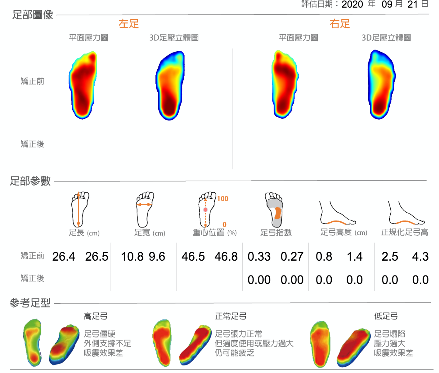 筆者的足底評估報告(圖片來源:黃書韋)